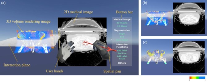 20230521-开云网医学院博士生张楠、杨讷与李阳曦在中国生物医学工程大会暨创新医疗峰会上获奖-张楠-基于三维空间交互的宫颈癌靶区勾画虚拟现实环境总览.jpg